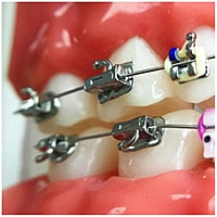 U Ortho Beggs Bondable Tube 0.022 With Hook