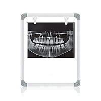 OPG X-Ray Film Viewer LED with Sensor – Dental Radiography Viewer