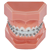 Koden Basic Series MBT Metal Bracket Kits (Normal) |