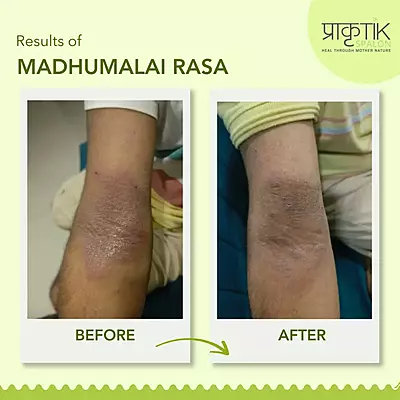 Madhumalai Rasa
